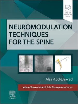 cover image of Neuromodulation Techniques for the Spine